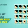 hair loss stages