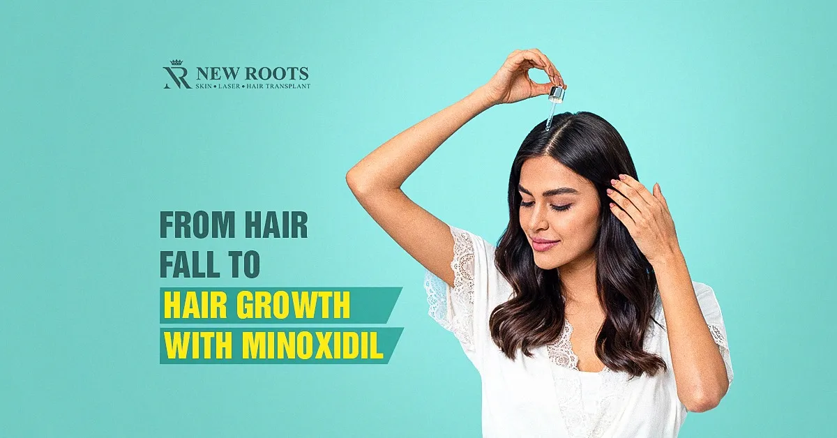 minoxidil before and after