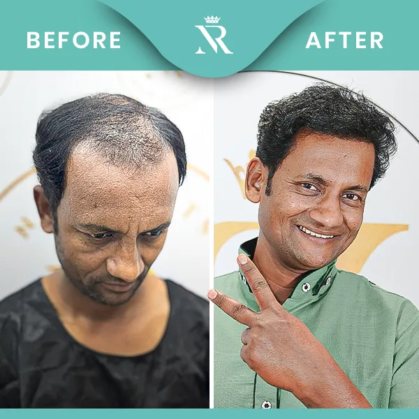 Celebrity - Hair Result