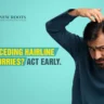 How to Stop a Receding Hairline Naturally