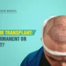 Is a hair transplant permanent