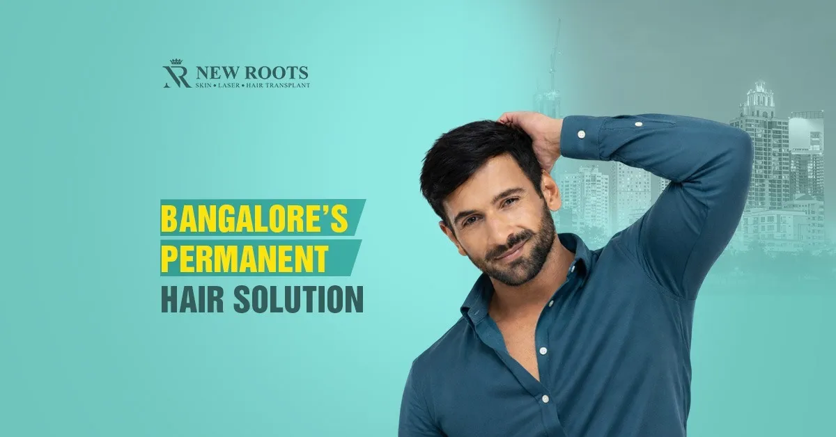 Permanent Hair Replacement in Bangalore