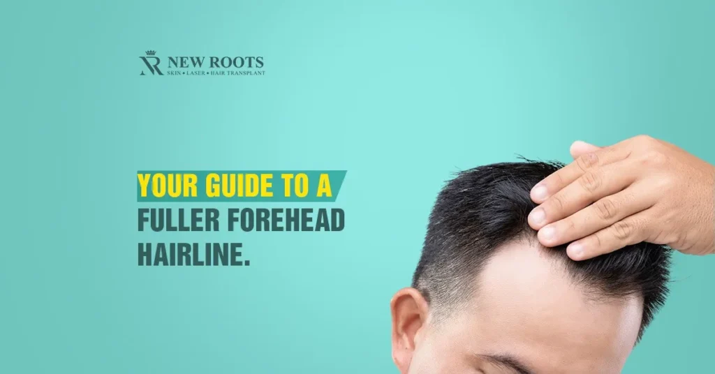 how to grow hair on the forehead