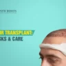 Hair Transplant Side Effects
