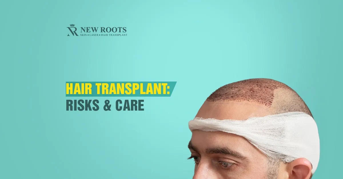 Hair Transplant Side Effects