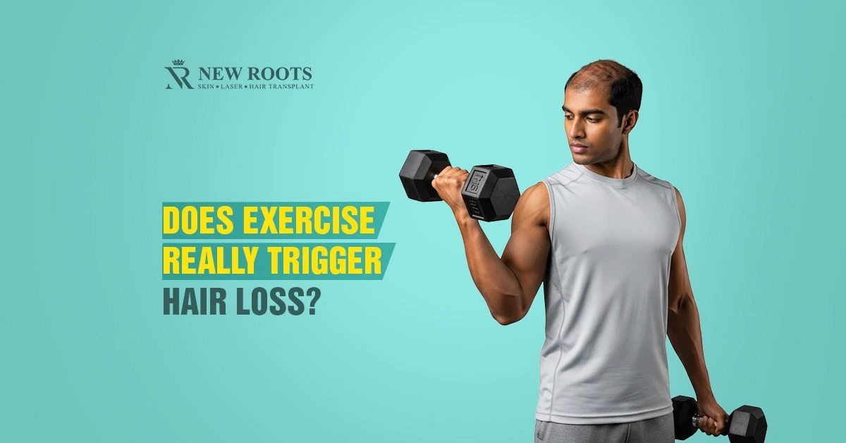 Does Exercise Cause Hair Loss