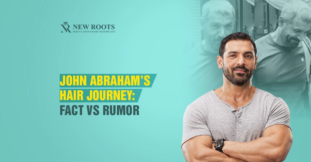John Abraham Hair Loss