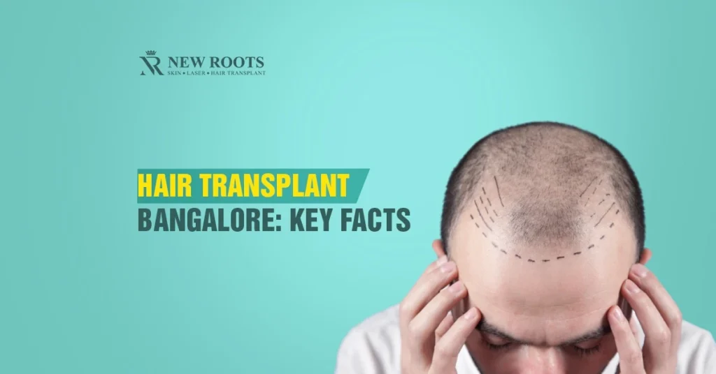 hair transplant in Bangalore