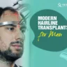 Hairline Transplant Before and After Male