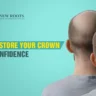 crown thinning hair transplant