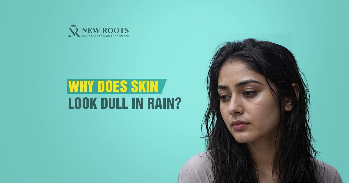 monsoon dull skin, rainy skincare