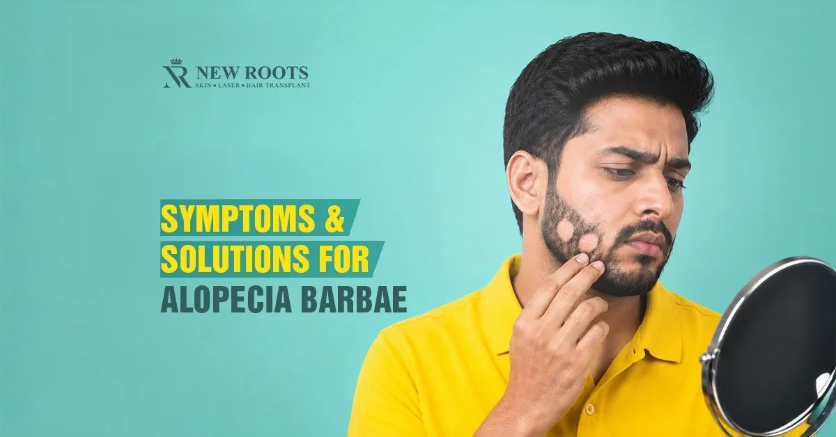 alopecia barbae cure