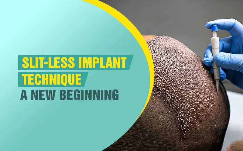 Slit-less Implant Technique