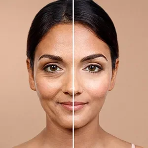 Under eye rejuvenation