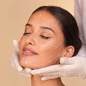 face fillers