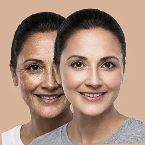 skin rejuvenation